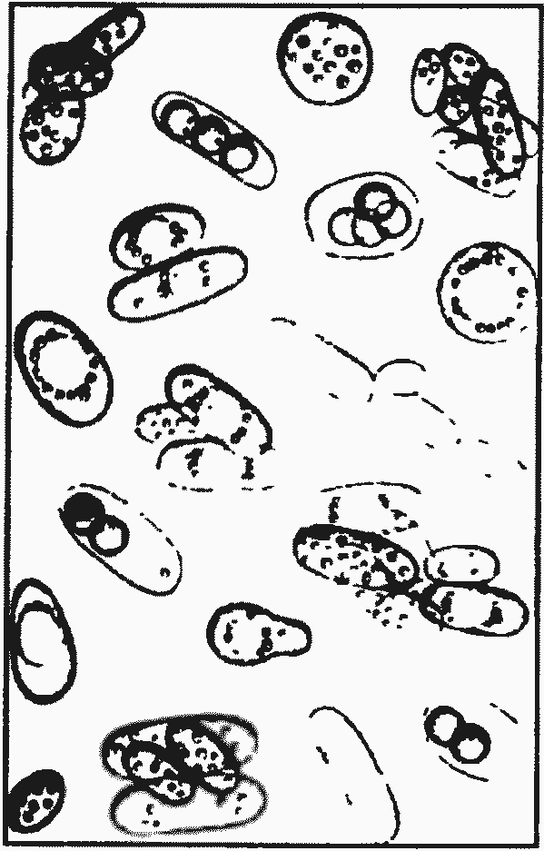 Микробиология вина. Saccharomyces Vini. Микрофлора возбудителей маслянокислого брожения рисунок. Saccharomycodes ludwigii.